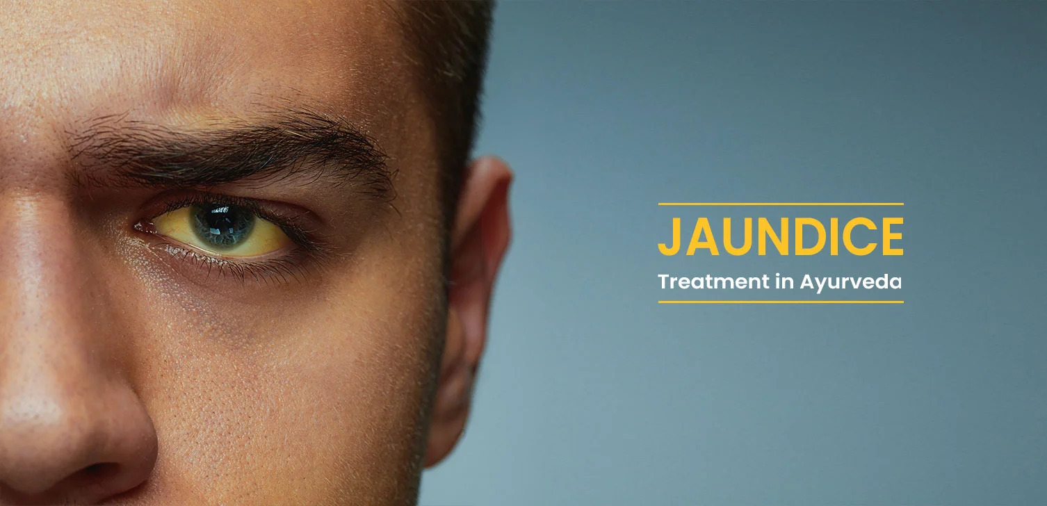 Ayurveda on Jaundice