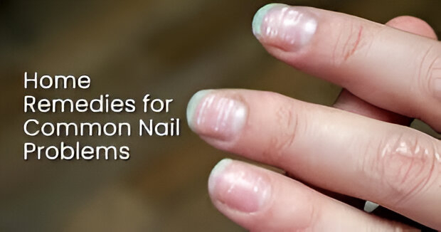 Ayurvedic nail care